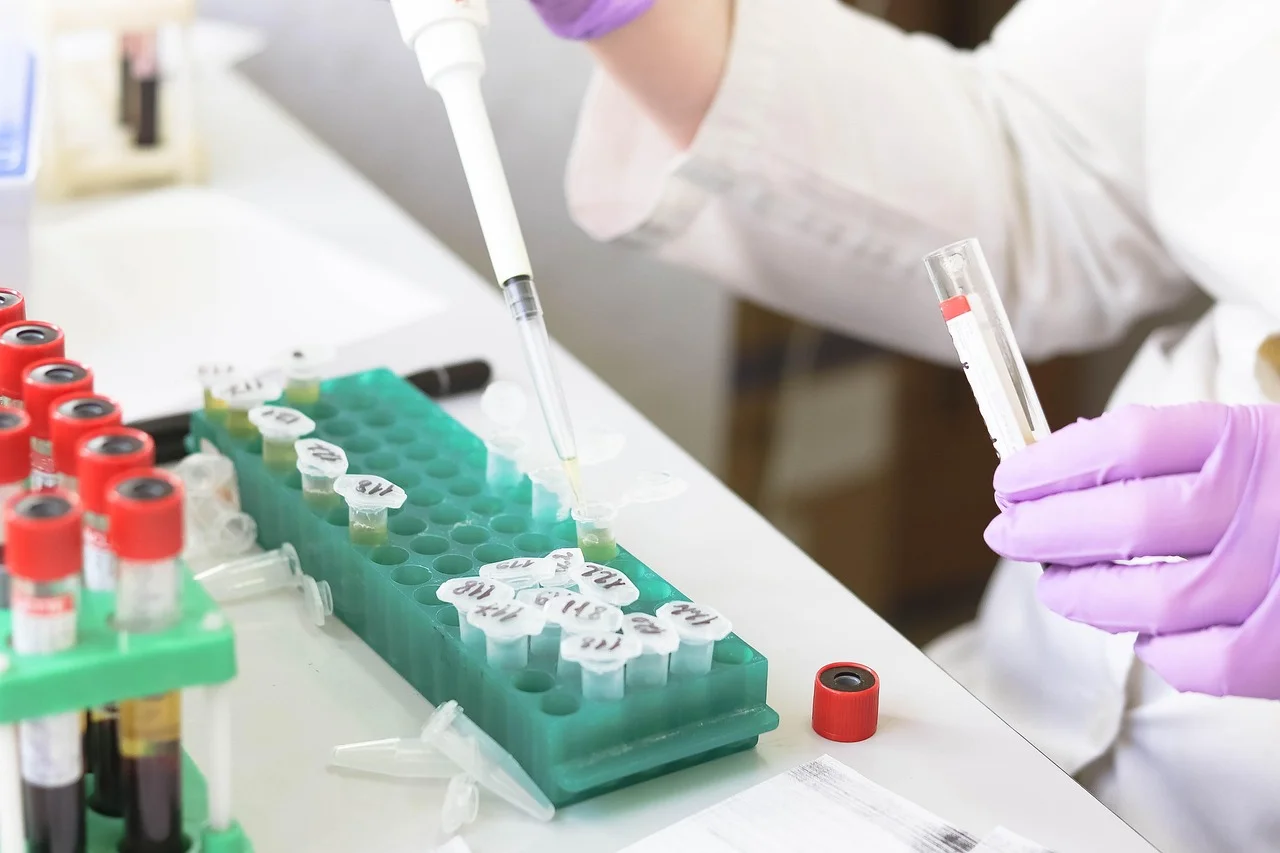 Mikrobiologiczna remediacja środowiska — oczyszczanie gleby z metali ciężkich